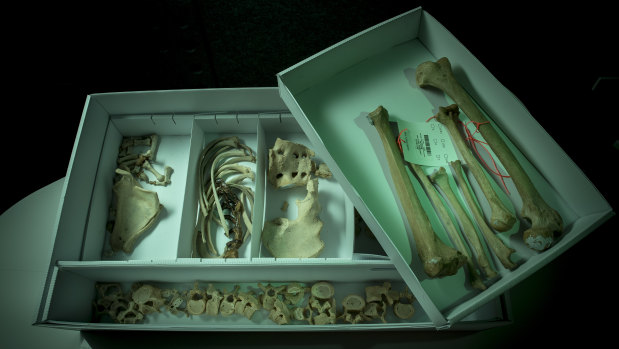 The bones were donated to Sacred Heart's Prahran opportunity shop.