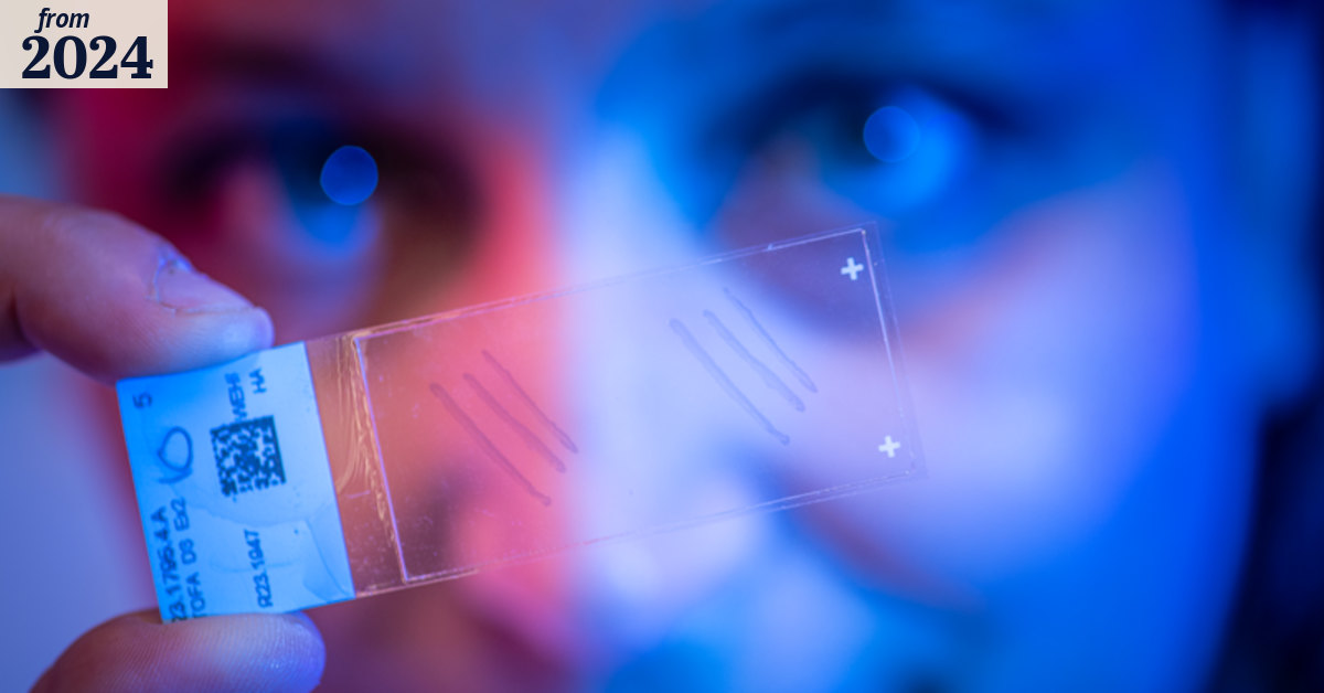 Toxic epidermal necrolysis: How a Melbourne team helped solve the ...