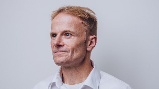 Professor Richard Scolyer is recovering at home with a long scar on the left side of his head.