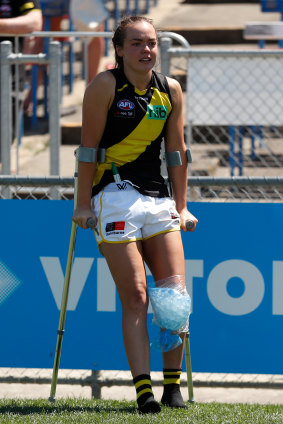 Hannah Burchell on crutches after the match.