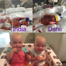 India and Dahli Greenhalgh are now thriving after being born more than three months premature.