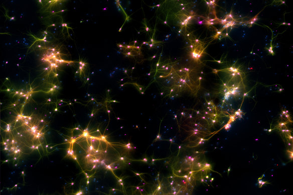 A microscope image of DishBrain, showing connections forming between the neurons.