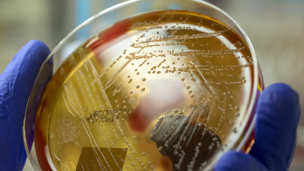 A microbiologist holds an agar plate showing the destruction of red blood cells caused by the streptococcus bacteria.