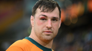 Nick Frost sports a black eye after the Wallabies’ heavy defeat.