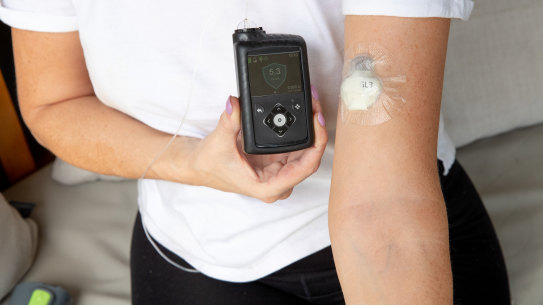More than 90,000 Australians now use a wearable glucose monitoring device. 