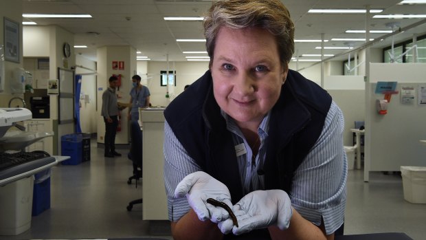 Kay Maddison, hand clinical nurse consultant at the hand clinic in Sydney Hospital holds a Richardsonianus leech. 