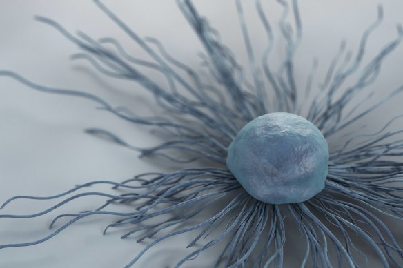 A representation of a cervical cancer cell.