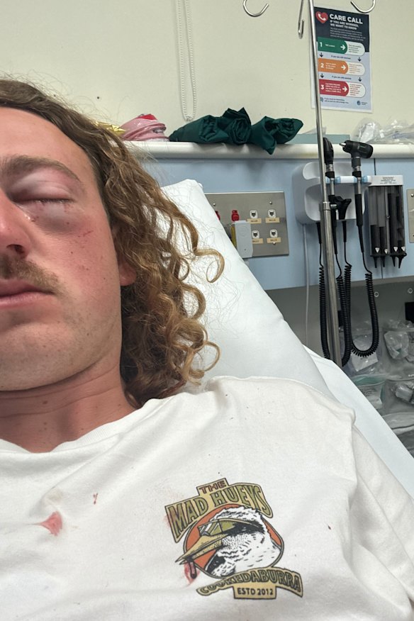 Will Salter in hospital after the Sorrento fight.