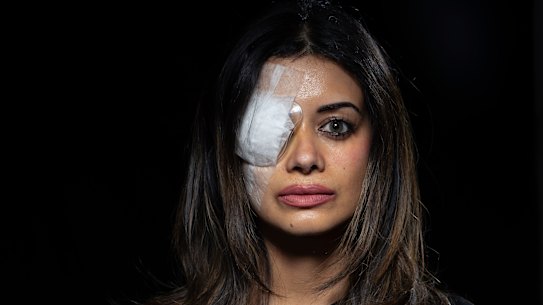 Former Greens candidate Hannah Thomas has been warned she will likely never regain full vision in her right eye after an injury she suffered when police broke up an anti-Israel protest last month.
