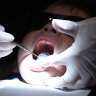 Up to one in three kids have tooth decay, and sugar is to blame: experts
