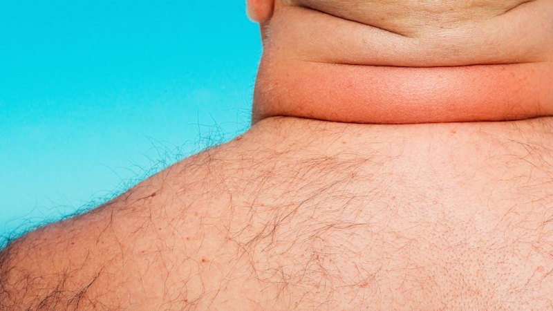 What does a thick neck have to do with heart health? Quite a bit, actually