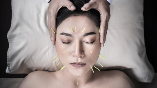 Cosmetic acupuncture has gained traction in Australia, as more people seek natural facial treatments.