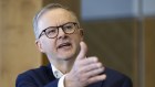 Anthony Albanese