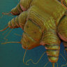 A close-up view of the cause of scabies: the Sarcoptes scabiei mite.