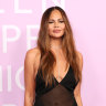Chrissy Teigen has been open about her cosmetic surgery, including the removal of her breast implants.