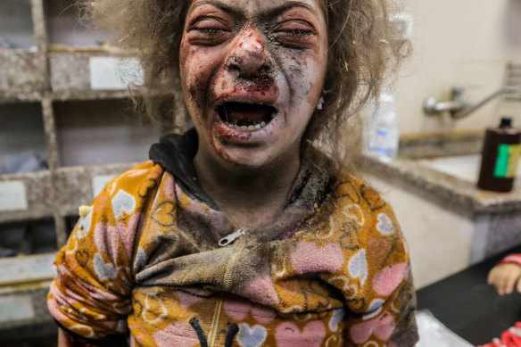 A child injured in Israeli airstrikes arrives at Nasser Medical Hospital  in Khan Younis, Gaza.