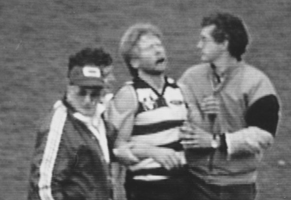 Geelong’s Neville Bruns is helped from the field with a broken jaw in 1985.