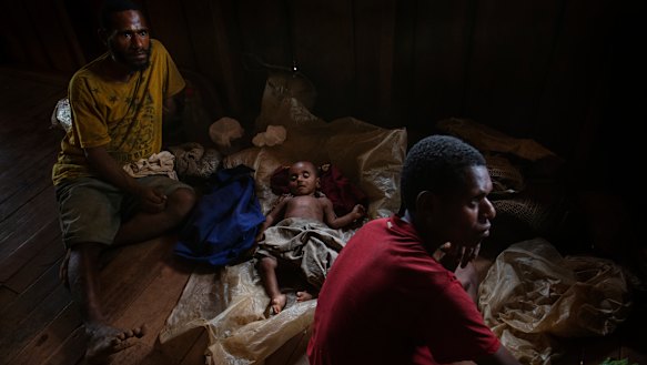 A father, Mufuli, and mother, Oba, with their twin babies (including one with club feet) at the Mougulu health centre ward.