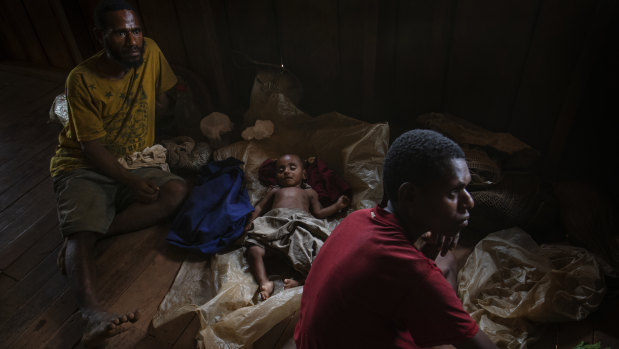 A father, Mufuli, and mother, Oba, with their twin babies (including one with club feet) at the Mougulu health centre ward.