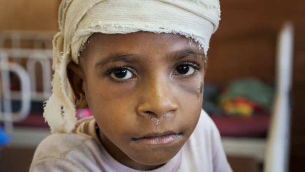 Falling rocks hurt five-year-old Douglas Jacob when a 7.5 magnitude earthquake hit Papua New Guinea on February 26. It is estimated 125,000 children are in need of help in PNG.