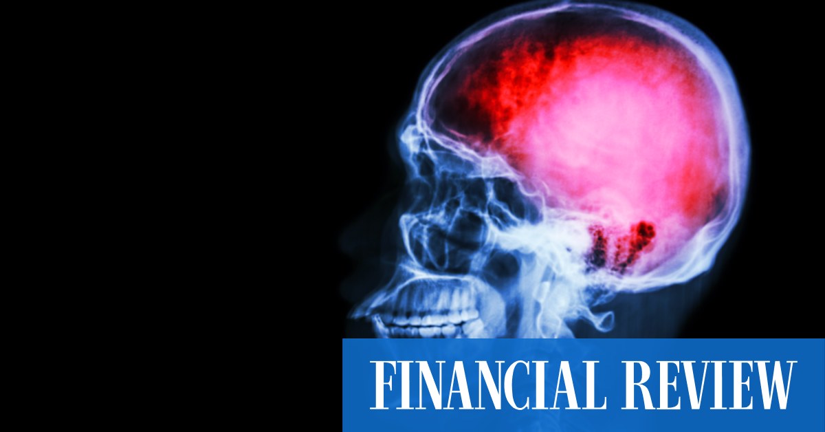 afr.com - Sarah Thompson, Kanika Sood, Emma Rapaport, Angira Bharadwaj - Third time lucky? Medtech Nicolab targets ASX float with pre-IPO raise