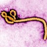 WHO declares global health emergency over Ebola outbreak. This rare variant has no approved treatments
