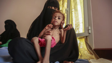 A woman holds a malnourished boy at the Aslam Health Centre in Hajjah, Yemen, late last year.