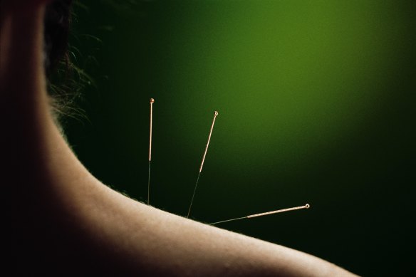 Western medical practitio<em></em>ners doubt the efficacy of acupuncture, as they cannot locate meridians – energy paths through the body. 