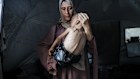 Muhammad Zakariya Ayyoub al-Matouq, 1, is facing life-threatening malnutrition.