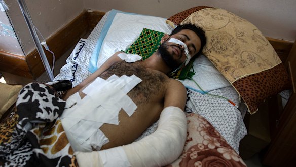 A 22-year-old man at Shifa hospital in Gaza City, where he is receiving treatment for wounds caused by an Israeli strike that hit his family house in town of Beit Hanoun.  J