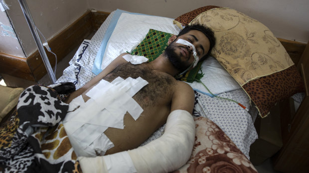 A 22-year-old man at Shifa hospital in Gaza City, where he is receiving treatment for wounds caused by an Israeli strike that hit his family house in town of Beit Hanoun.  J