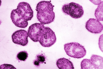 Health authorities have observed an increase in sexually transmitted infections such as gonorrhea, pictured, in recent years. 