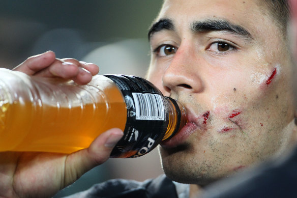Shaun Johnson sporting the scars of his debut Test, age 22, against the Kangaroos in 2012.