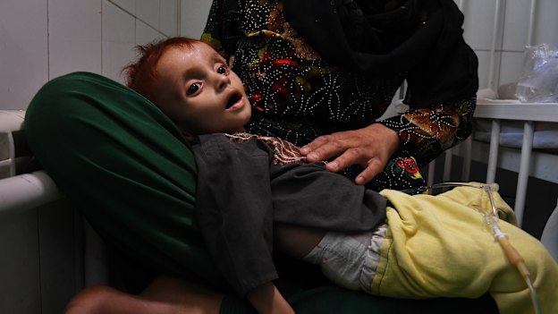 Saber. 10 months old and suffering from severe acute malnutrition, is comforted by his mother Shahr Banoo, 15.