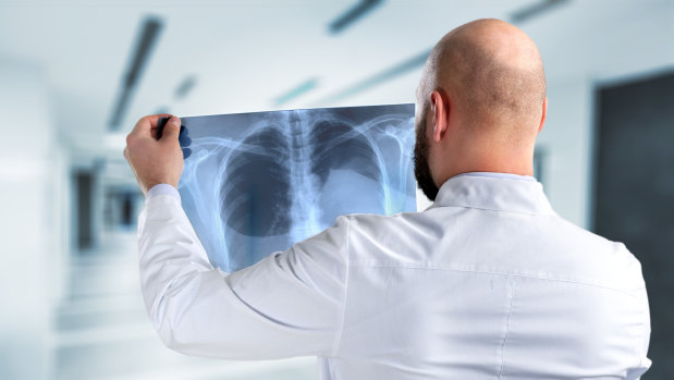 Lung cancer is one of the most aggressive forms of cancer.