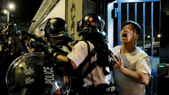 A bleeding man is taken away by policemen after attacked by protesters outside Kwai Chung police station in Hong Kong.