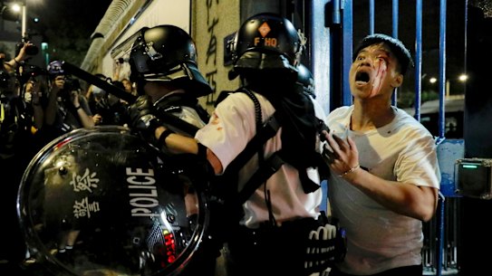 A bleeding man is taken away by policemen.