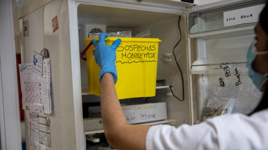 A technician takes a bucket with suspected monkeypox samples to be tested at the microbiology laboratory of La Paz Hospital in Madrid, Spain.