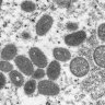 An electron microscope image shows mature, oval-shaped monkeypox virions.