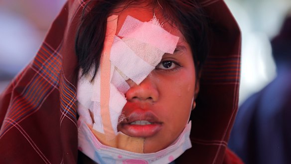 An earthquake victim is bandaged at a makeshift hospital in Palu.