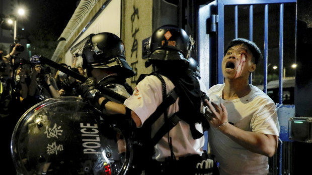 A bleeding man is taken away by policemen after being attacked by protesters outside Kwai Chung police station in Hong Kong.