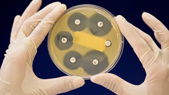 Medical research institutes are grappling with cuts to their grants as a result of US changes.