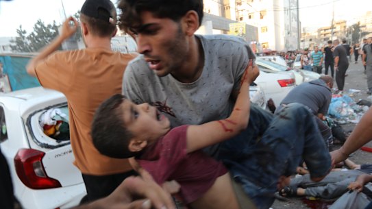 An injured Palestinian boy is carried from the ground following an Israeli airstrike outside the entrance of the al-Shifa hospital in Gaza City.