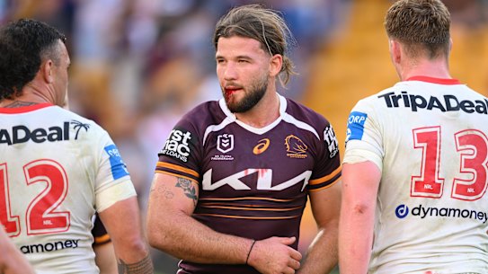 Pat Carrigan suffered a facial laceration in the Brisbane Broncos defeat to the Dragons.