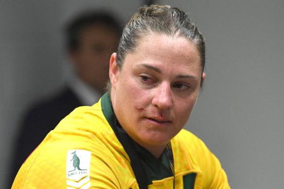 Steph Hancock’s stitched up lip after she first ‘retired’ from rugby league following the 2017 World Cup final.