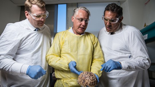 Michael Buckland of RPA, Chris Nowinski from Concussion Legacy Foundation and former rugby player Colin Scotts examine a brain.