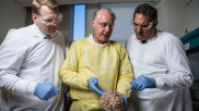 Michael Buckland of RPA examines a brain.