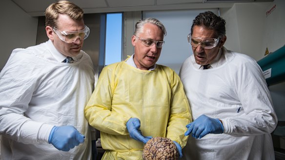 Michael Buckland of RPA, Chris Nowinski from Concussion Legacy Foundation and former rugby player Colin Scotts examine a brain.