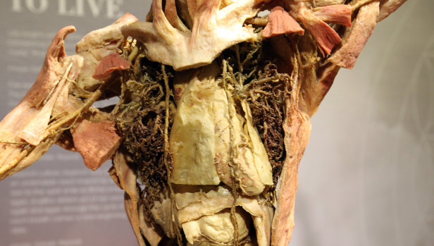 Details of a human body as seen at the Real Bodies exhibition at Kennedy Hall. 