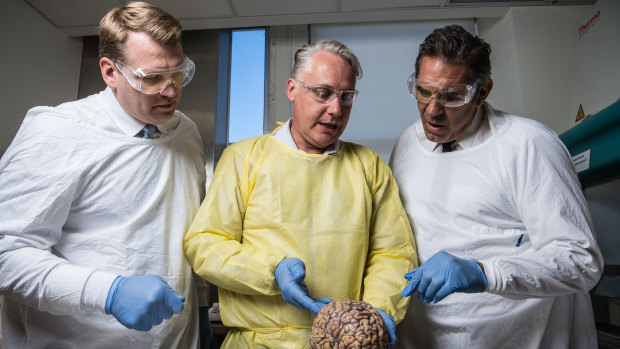 Michael Buckland of RPA, Chris Nowinski from Concussion Legacy Foundation and former rugby player Colin Scotts examine a brain.